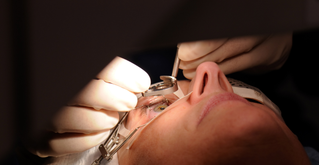 apakah-lasik-bisa-dilakukan-sampai-2-kali