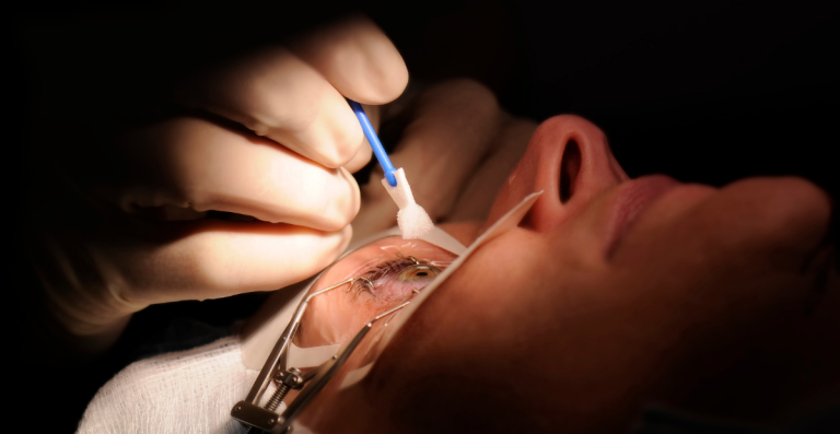 Sudah Operasi LASIK, Apakah Tetap Butuh Kacamata?