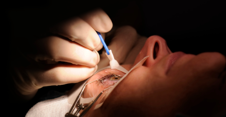 ReLEx SMILE vs LASIK, Apa Bedanya dan Mana yang Lebih Efektif?